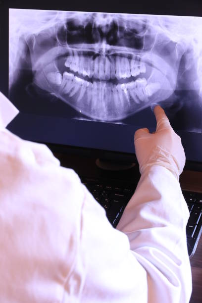 Best Emergency Dental Surgery in Dixon, CA