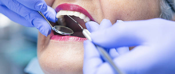 Best Emergency Tooth Extraction in Dixon, CA