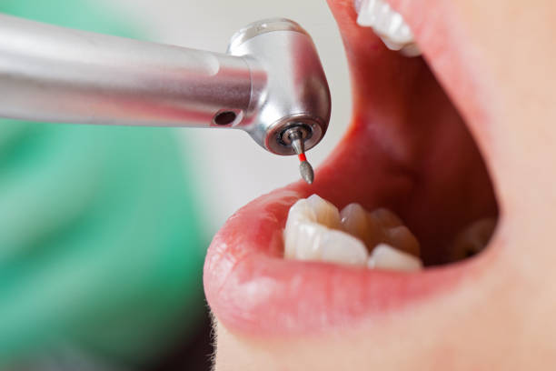 Best Emergency Dental Surgery in Dixon, CA